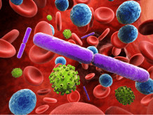 sepsis